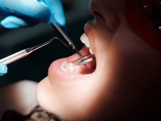 Why Braces Don’t Have to Hold You Back in the Arts