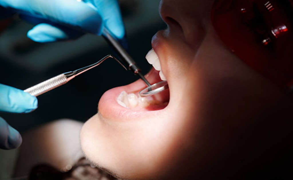 orthodontic braces
